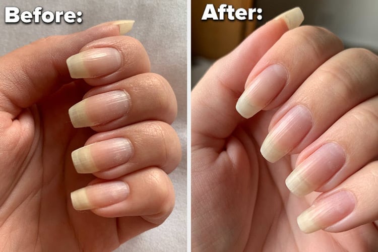 همه چیز درباره ی کاشت ناخن انواع مراحل انجام آن